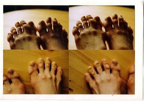 Gnarly Hands, Feet, Ears and Noses: Images Hard to Unsee